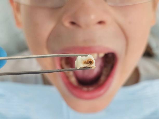 Best After-Hours Emergency Dentist in Seville, OH